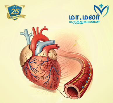 Angiogram and Primary Angioplasty