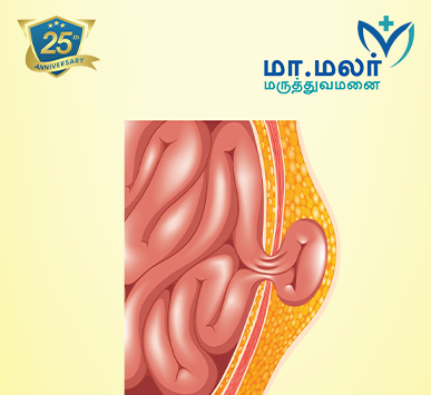 Laparoscopic Hernia Repair